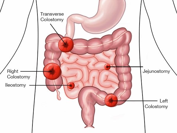 July 02 -NCLEX Daily Practice Questions