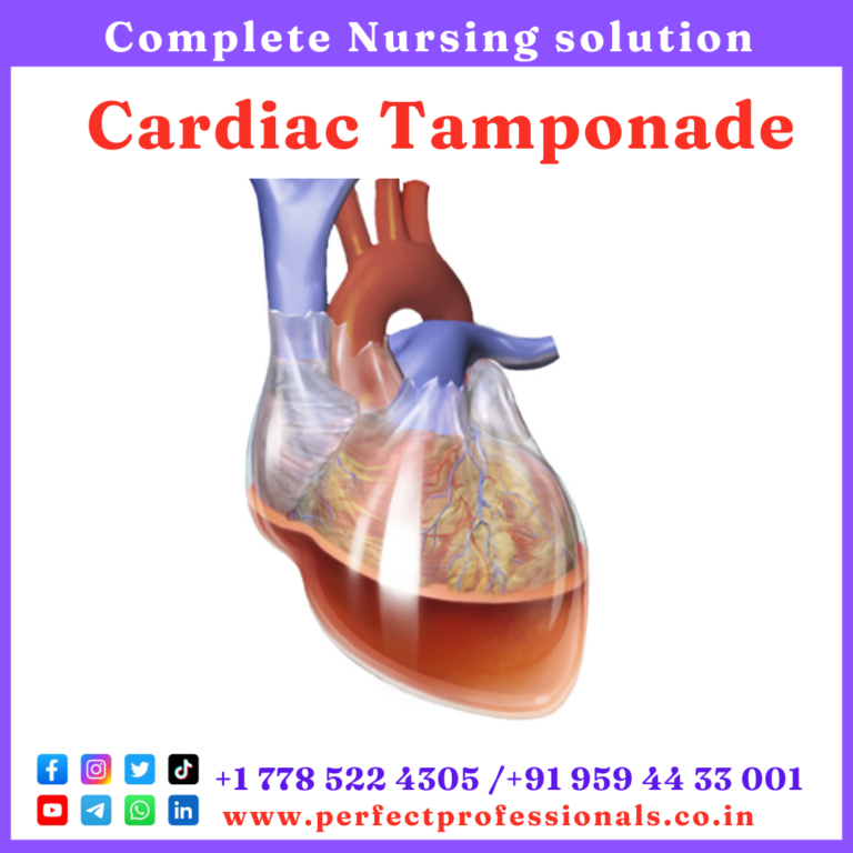 Essential Guide 2 Cardiac Tamponade